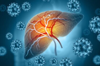 Roche to buy 89bio for up to $3.5b