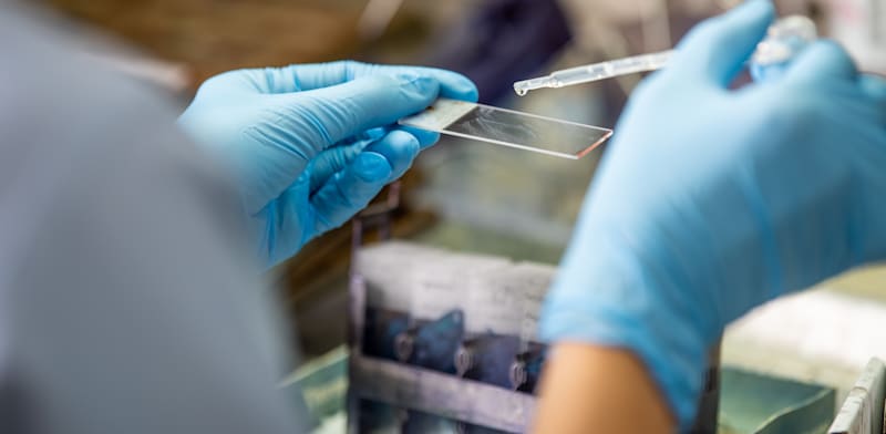 Israeli oncology treatment co Starget Pharma raises $18m